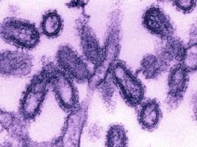 Worldwide flu Epidemic Kills 30 Million