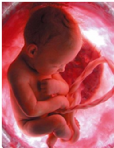 9 meses de gestación