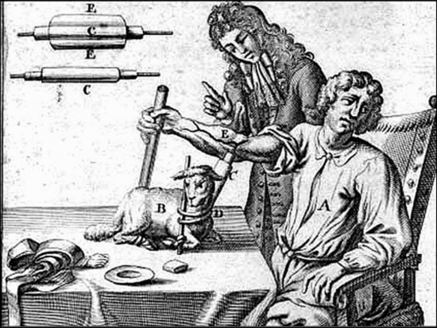 Transfunción Sanguínea