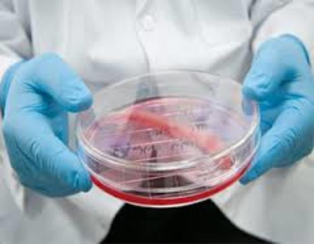 Primer Trasplante De Un Órgano Completo Cultivado