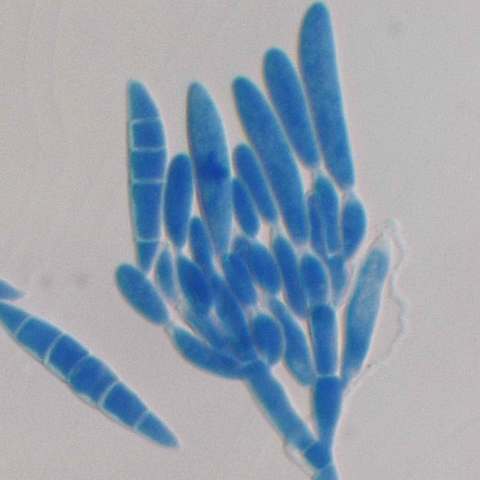 descubrimiento de hongo degradador de platico
