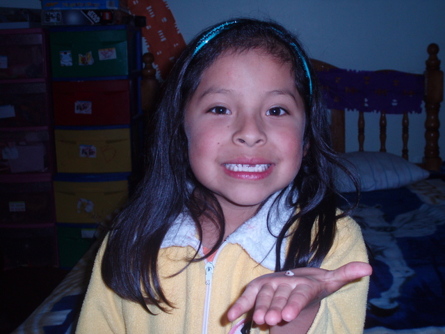 Primer foto de un diente caído