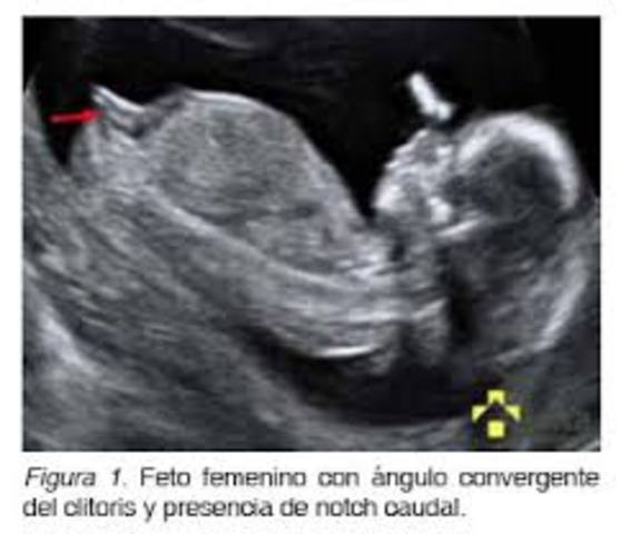 Semana 12 - Segundo Trimestre