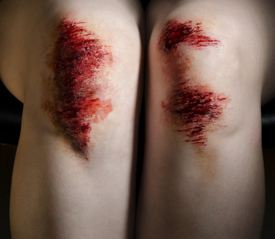 Sufrí mi primer accidente