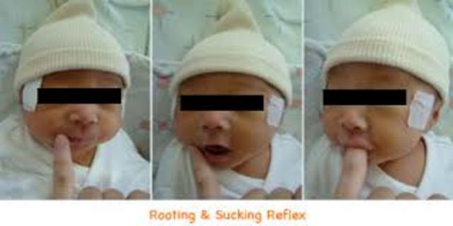 Present shortly after birth