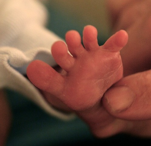 Present shortly after birth