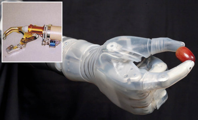 Helmut Lucas Invented the first Prosthetic Arm