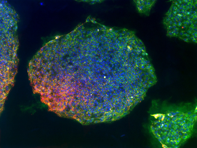 Generation of first Induced Pluripotent Stem Cells