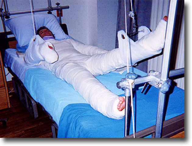 Crippled Finny=Shocked Gene Ch. 5 Pgs. 52-55