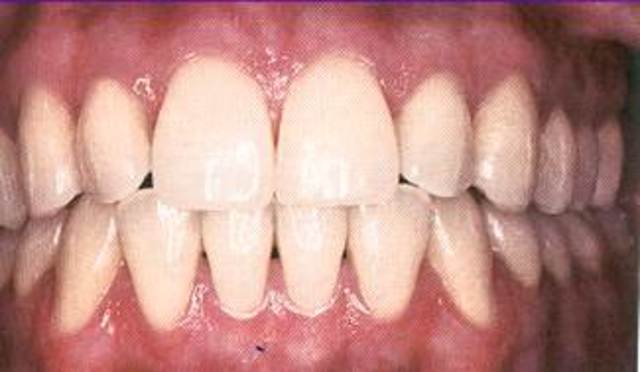 Servicio Pericial de Odontología Forense del imelcf