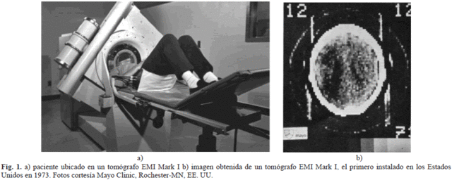 Godfrey Hounsfield presenta la llamada "Tomografía Axial Computarizada", TAC en sus siglas, el 20 de abril de 1972.