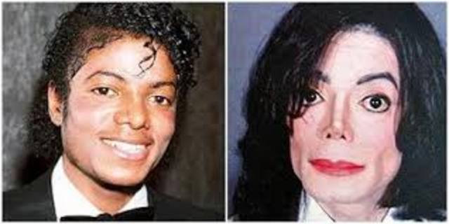Question arise about Jackson changing apperence and some wonder if he has had plastic surgery