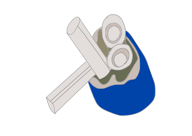 Corazon Artificial (Paul Winchell)