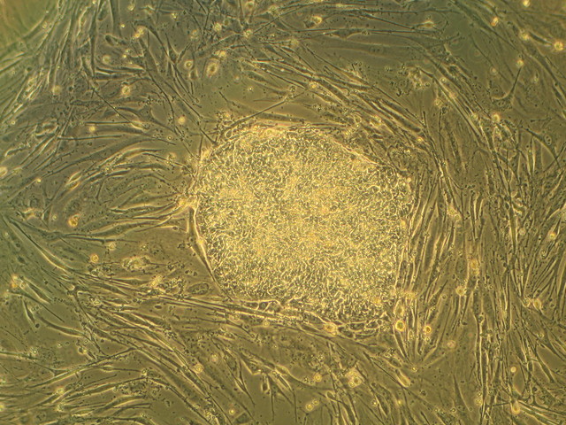 human stem cells