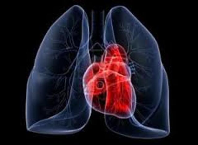 Trasplante de corazón y pulmón