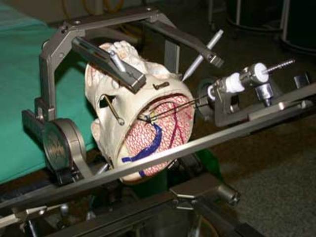 Spiegel, Wupos y Marks (1940)