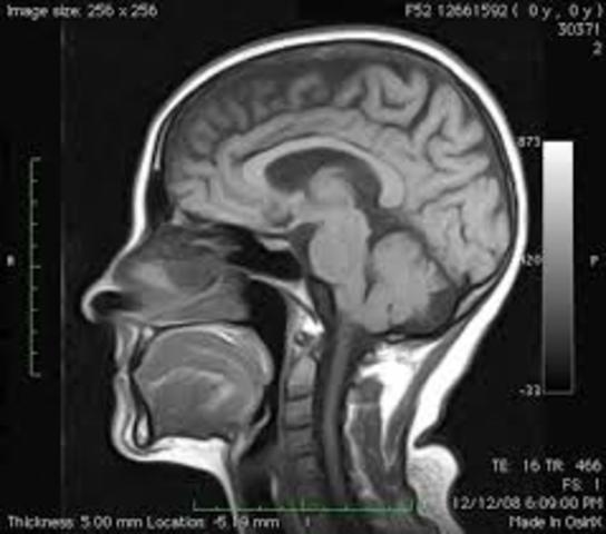 Cohen y Bookheimer (1994)