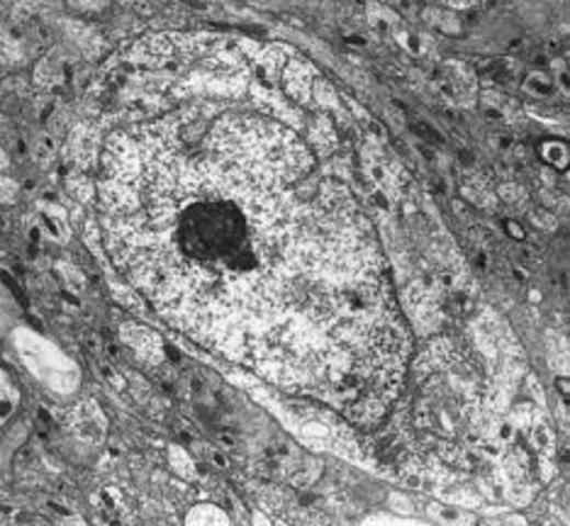 Primeros seres unicelulares eucariotas.