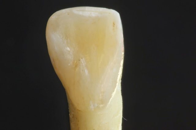 ES CAU LA MEUA PRIMERA DENT