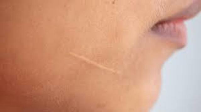 (2012) ALTRA CICATRIU I ALTRA VEGADA EN EQUADOR