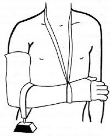 Em trenco el braç dret