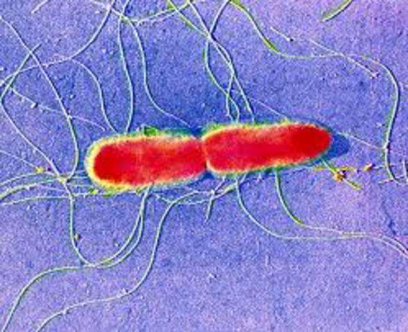 Τυφοειδής πυρετός