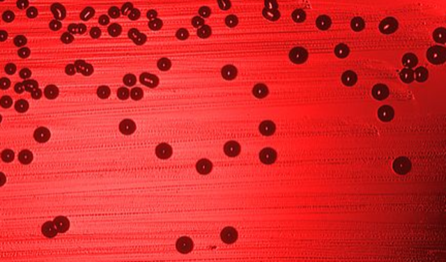 First complete genome