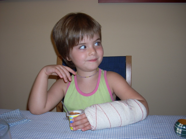 Cuando me rompí el brazo