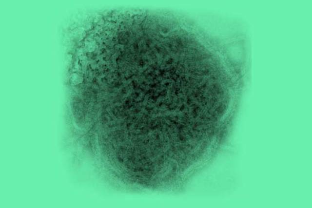 12 Confirmed Cases On Campus