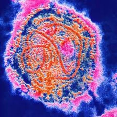 Probable Case Of Mumps At New Paltz High School