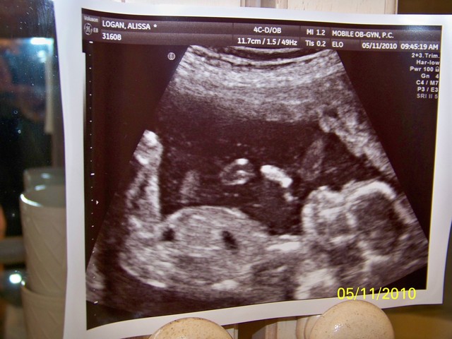 Tenley's ultrasound picture