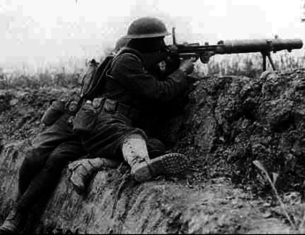 Loopgravenoorlog in Rusland