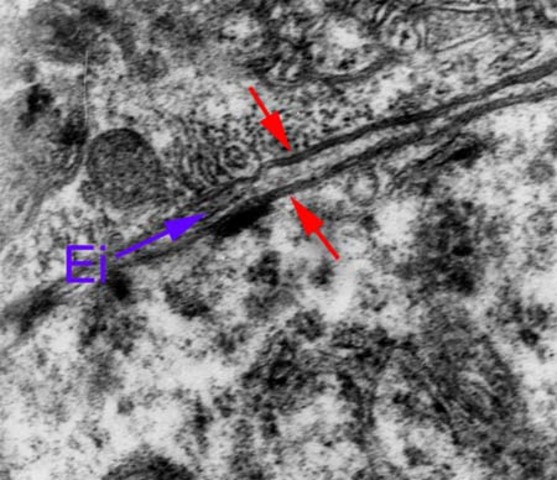 Membrana plasmática