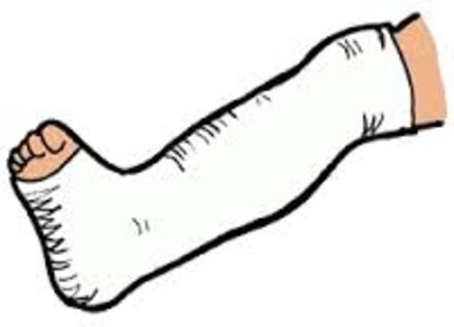 Yo rompí mi tobillo y mi muñeca.