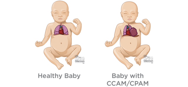 A trip to Paris, France!