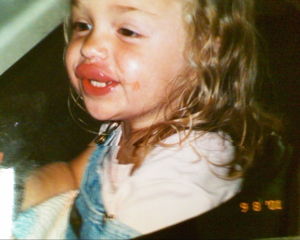 When I Got Stung By A Bee