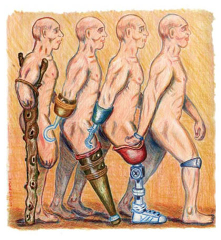 Artificial Limbs began to be built