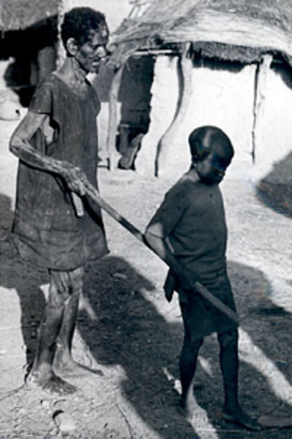 Onchocerciasis Control Program