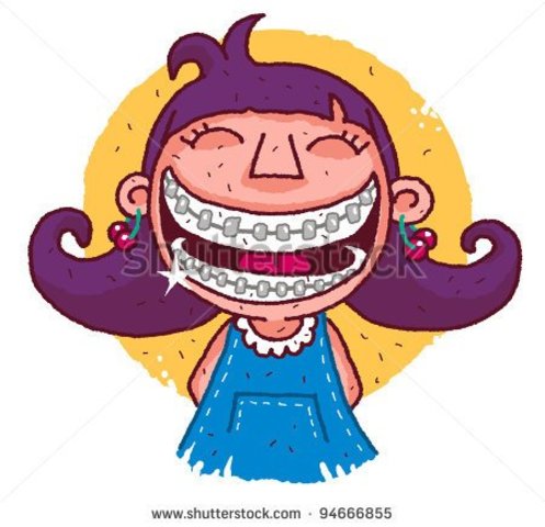 Braces