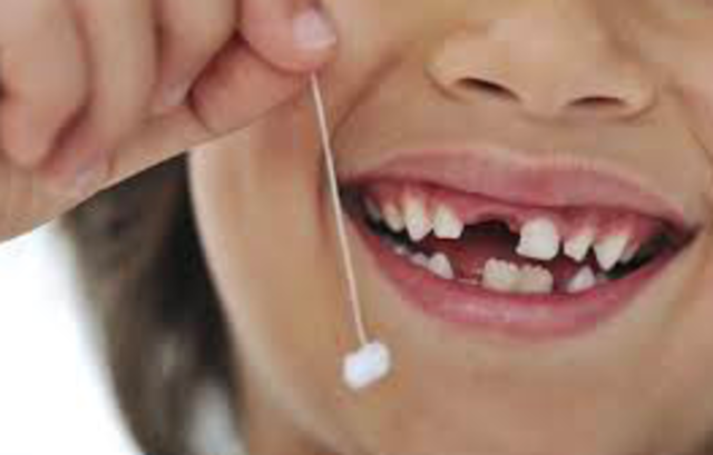 My first teeth felt down