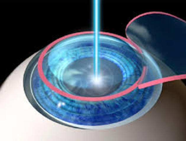 Se implementa la cirugia láser