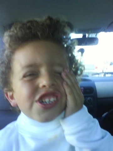 When my teeth start to come out