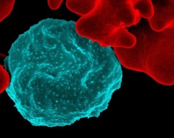 Nov. 6th, 1880-  Plasmodium falciparum is described as the causative agent of malaria