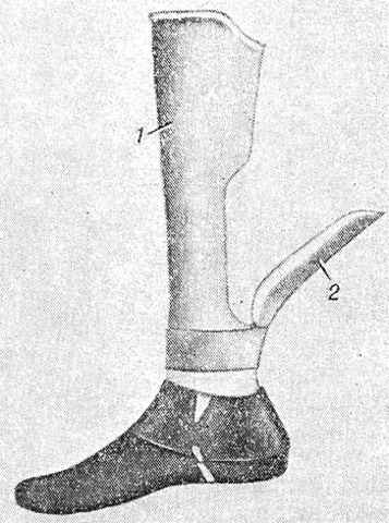 Механический протез ноги