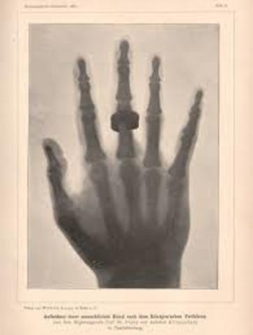 The First X-Ray