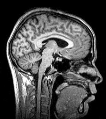 First MRI of Human Brain
