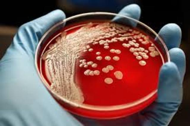 Discovery of Microbiology