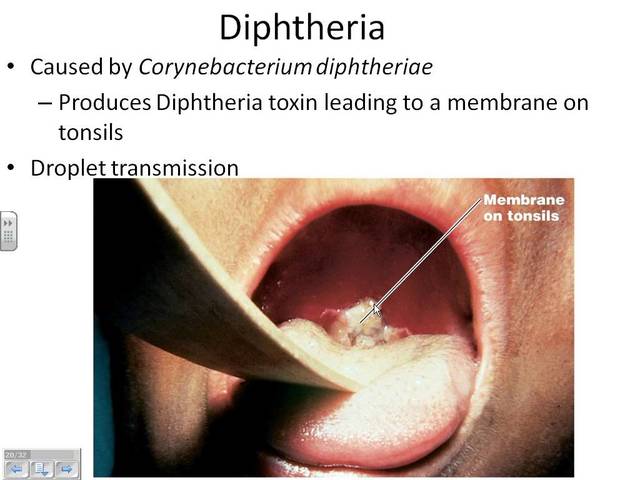 When they established that it could cause a disease.