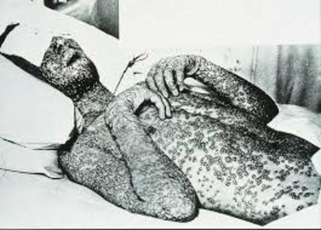 Plague In Surat India 1994