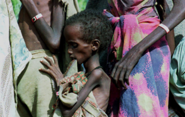 Somalia Death and Starvation